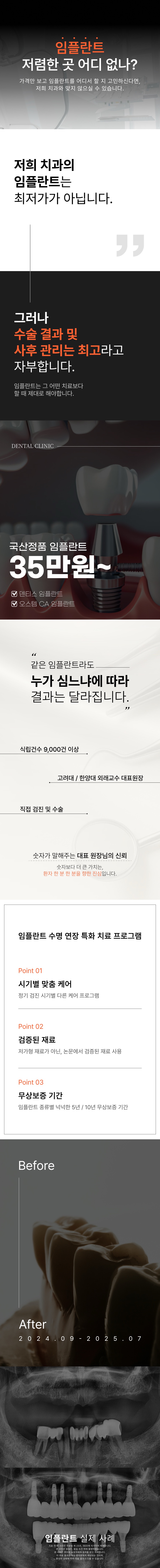 임플란트 건강한미소 - 전문 임플란트 치료 정보