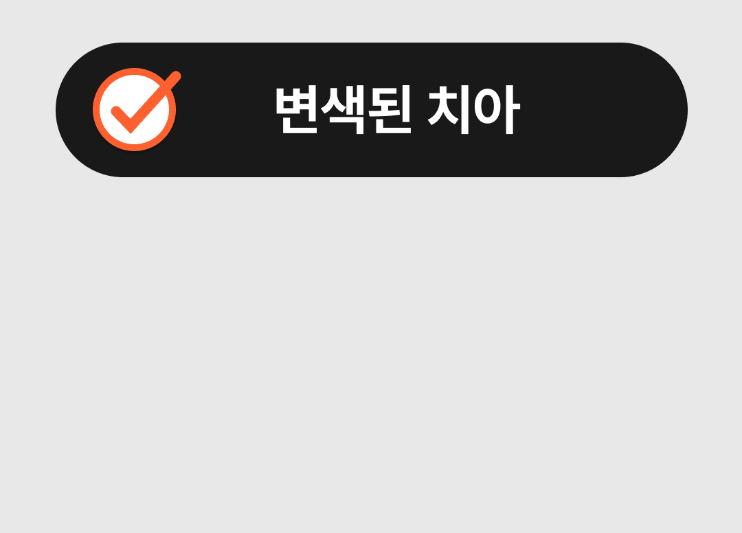 변색된 치아, 벌어진 치아, 선천적 왜소치